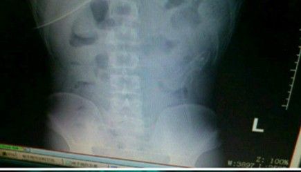 点击查看原图